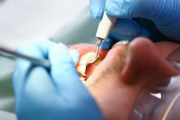 Best Knocked-Out Tooth Emergency  in Helena, MT