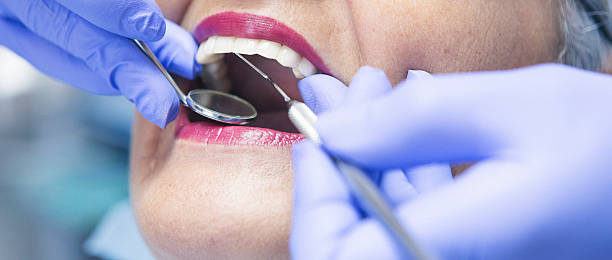 Emergency Dental Filling Replacement in MT